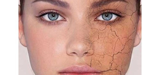 درمان خشکی پوست صورت