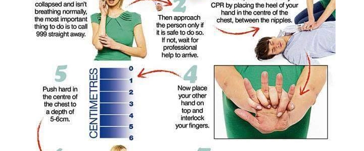 نحوه انجام احیای قلبی CPR